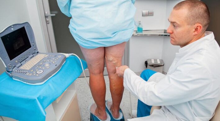 A varikoosák diagnosztizálása